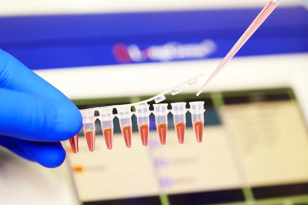 จะเลือกวัสดุสิ้นเปลือง PCR/qPCR ได้อย่างไร